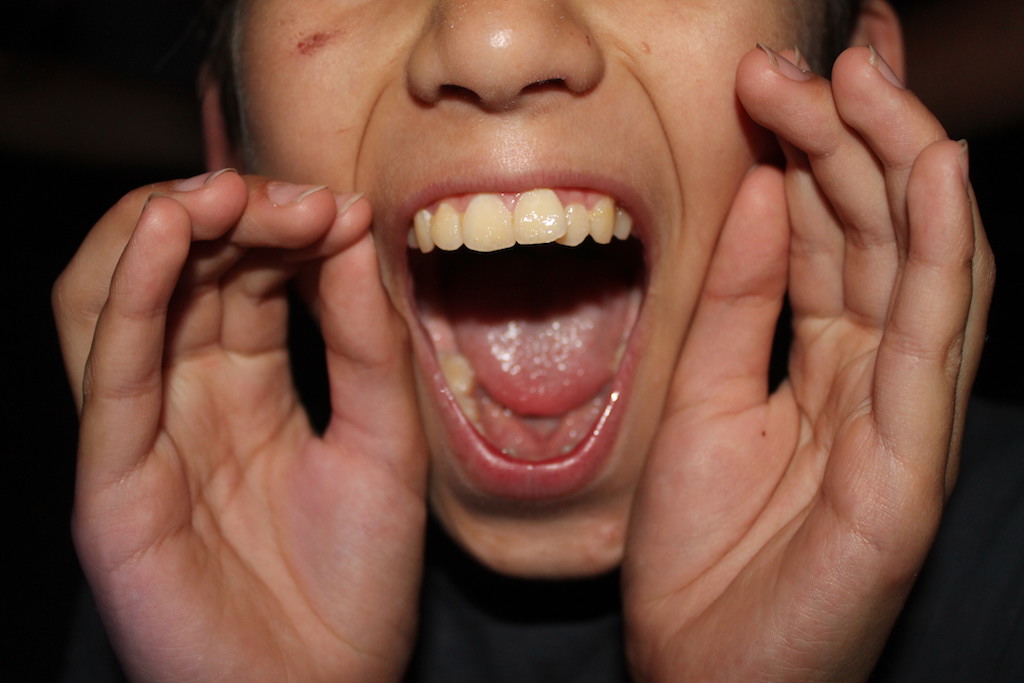 Village Camps International Summer Camp Ardèche, France 2019-07-26 https://www.villagecamps.com/journals_admin/images/2236-7370-DiscoBall13 copy.jpg Village Camps International Summer Camp Ardèche, France 2019-07-26 https://www.villagecamps.com/journals_admin/images/2236-7370-DiscoBall13 copy.jpg